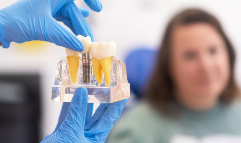 How Dr. Johnston at West Seattle Smile Co. Selects the Right Implant Size for Your Smile