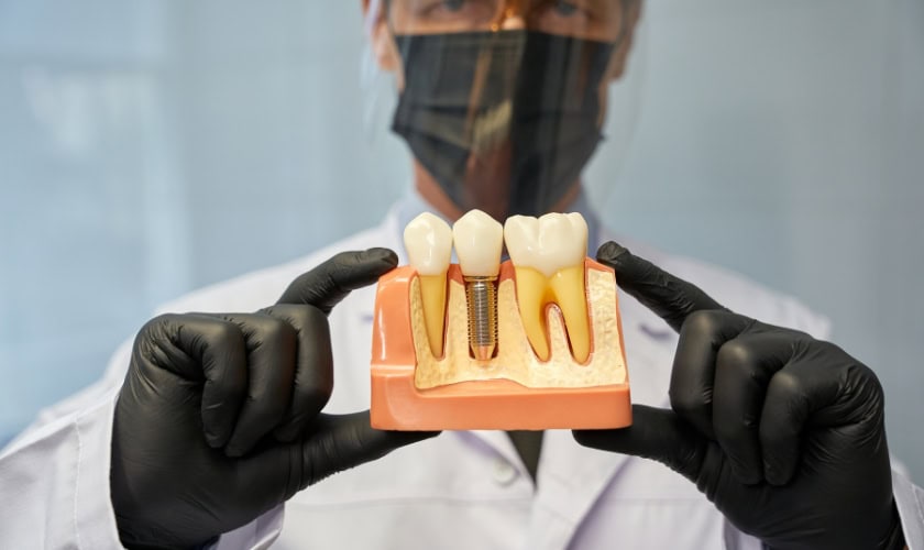 How to Care for Your Dental Implants? Tips for West Seattle Patients