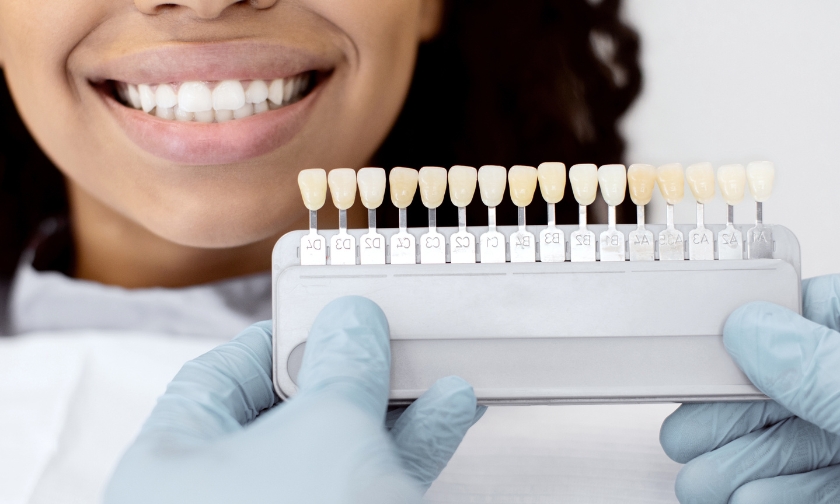 Can Veneers Be Replaced if They Chip or Wear Down?