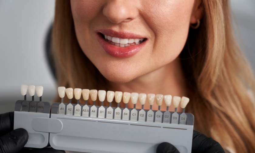 Can West Seattle Smile Co. Fix a Single ‘Dark Tooth’ with a Porcelain Veneer?