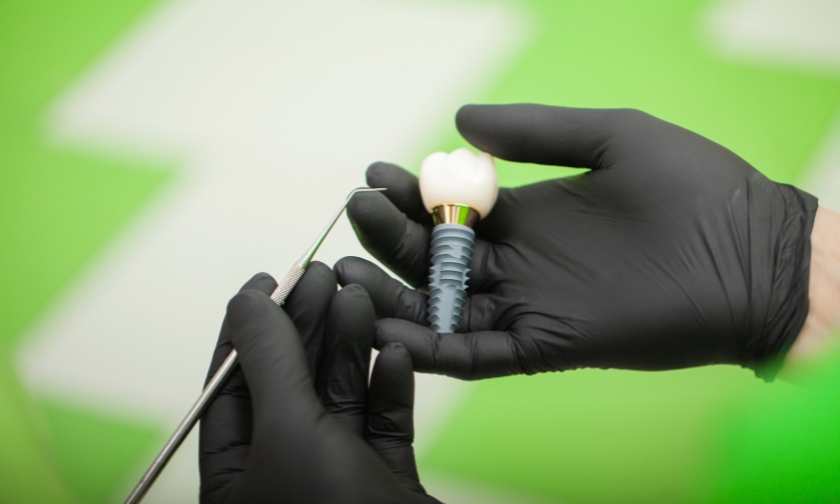 Millennials and Early Tooth Loss: Why Implants are the “Green” Choice