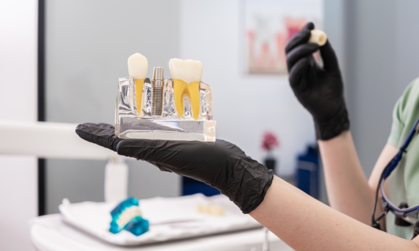 swelling and bruising after dental implant surgery